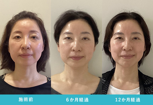 施術例